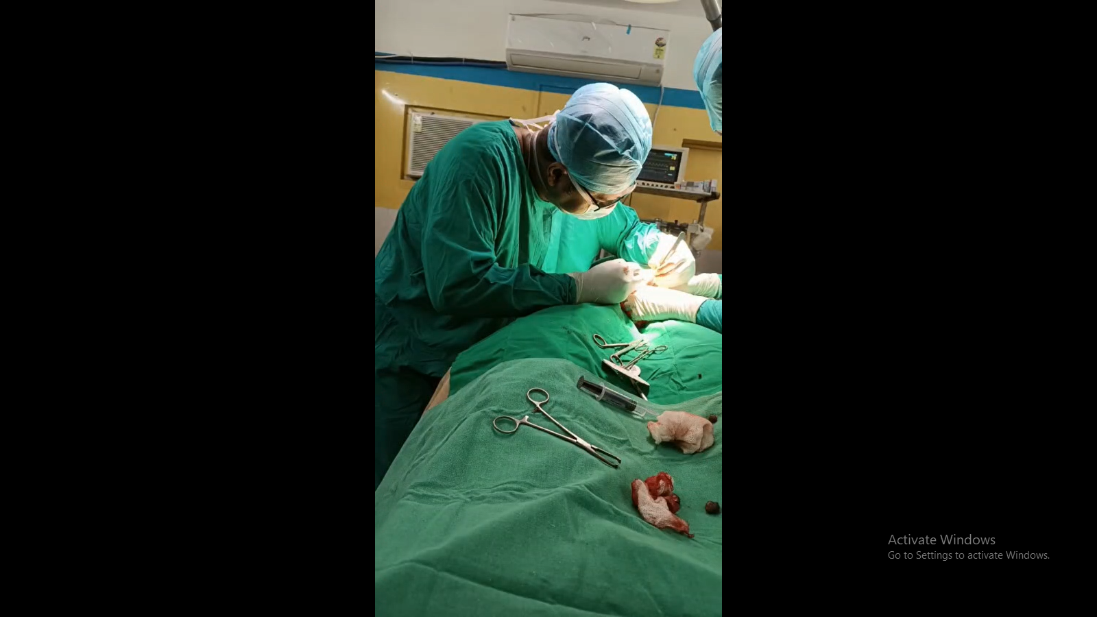 HIFU Treatment